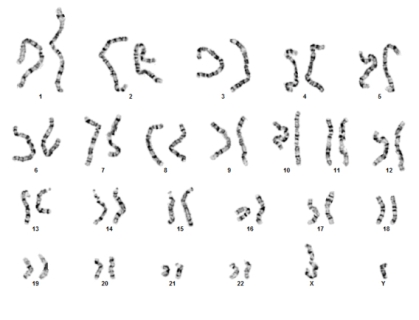 Image of chromosomes